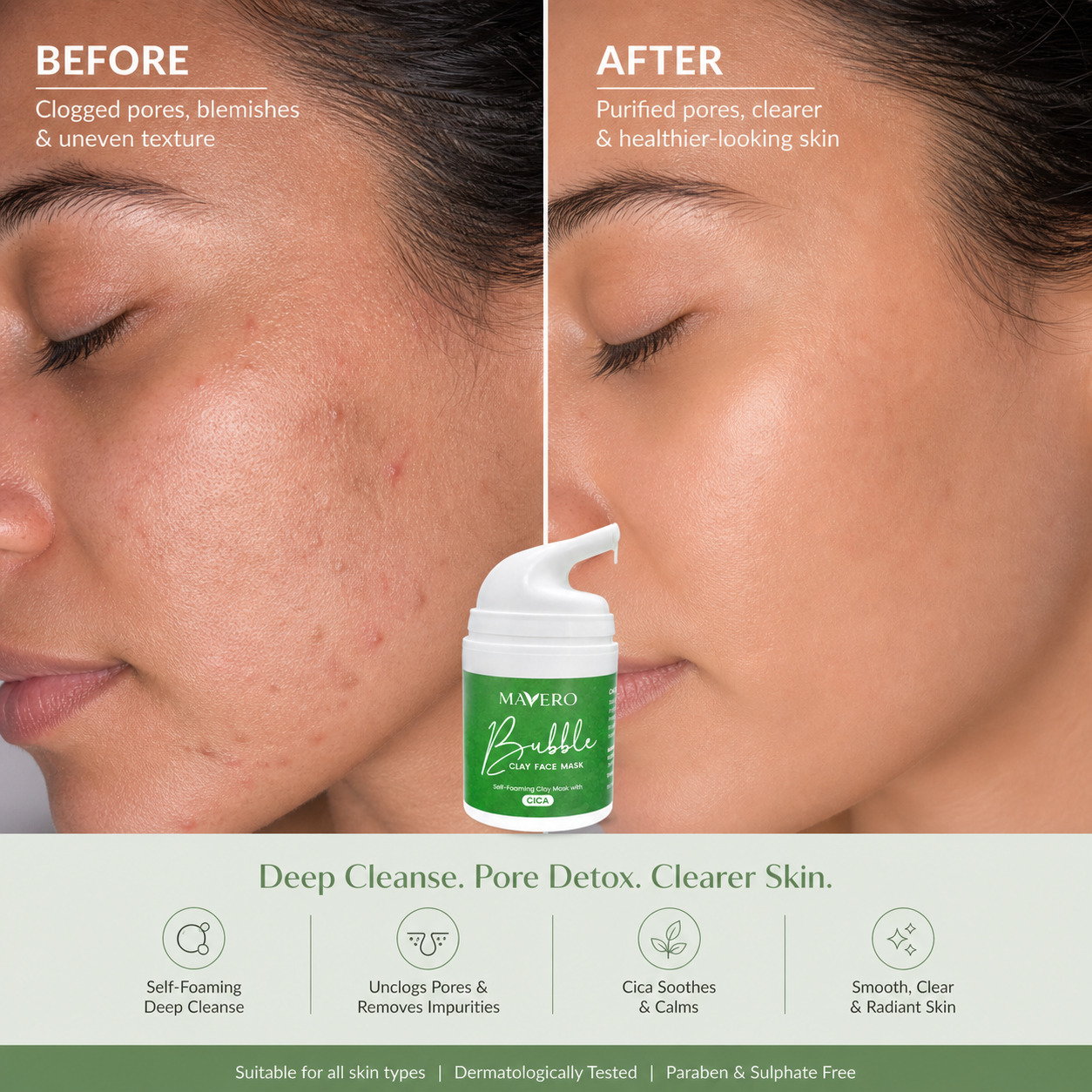 Before and after results of Mavero Bubble Clay Face Mask showing unclogged pores, acne reduction, smoother skin texture, deep pore detox, clearer skin, and healthy radiant glow with self-foaming CICA skincare.